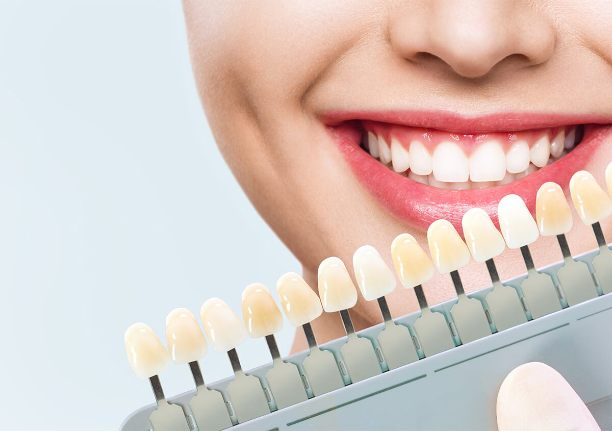 Consider Porcelain Veneers to Improve the Appearance of Your Smile and Self-Confidence
